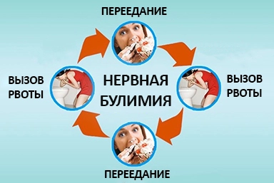 Лечение булимии в Шумихе
